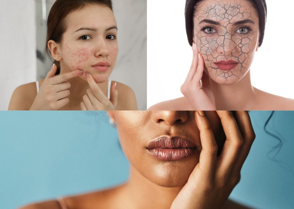 Skin quality protocols : peaux convenables au traitement